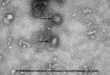 新型冠狀病毒傳染性比SARS弱嗎 新型冠狀病毒與SARS類似嗎 新型冠狀病毒傳染性比SARS弱嗎 新型冠狀病毒與SARS類似嗎