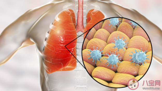 新型冠狀病毒肺炎的致死率高嗎 新型冠狀病毒會(huì)人傳人嗎