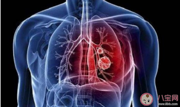 新型冠狀病毒感染了一定會發熱嗎 新型冠狀病毒前期的癥狀有哪些