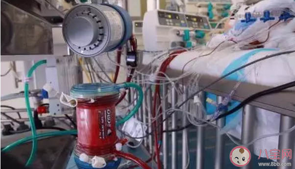 ecmo是什么意思 ecmo什么情況下用 ecmo是什么意思 ecmo什么情況下用