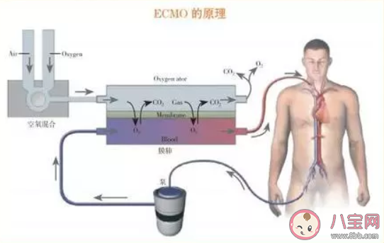 ecmo是什么意思 ecmo什么情況下用 ecmo是什么意思 ecmo什么情況下用