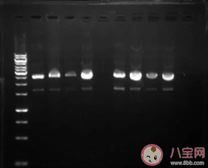 新型肺炎怎么進行核酸檢測 為什么核酸檢測這么慢