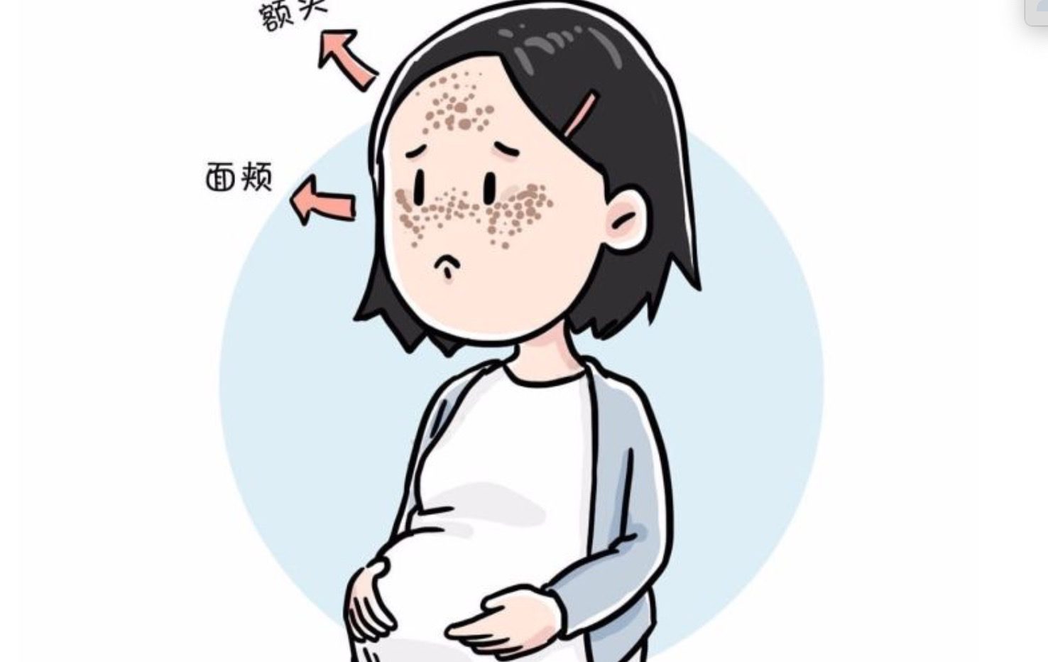 長斑缺什么維生素 長斑了怎么調理相關介紹