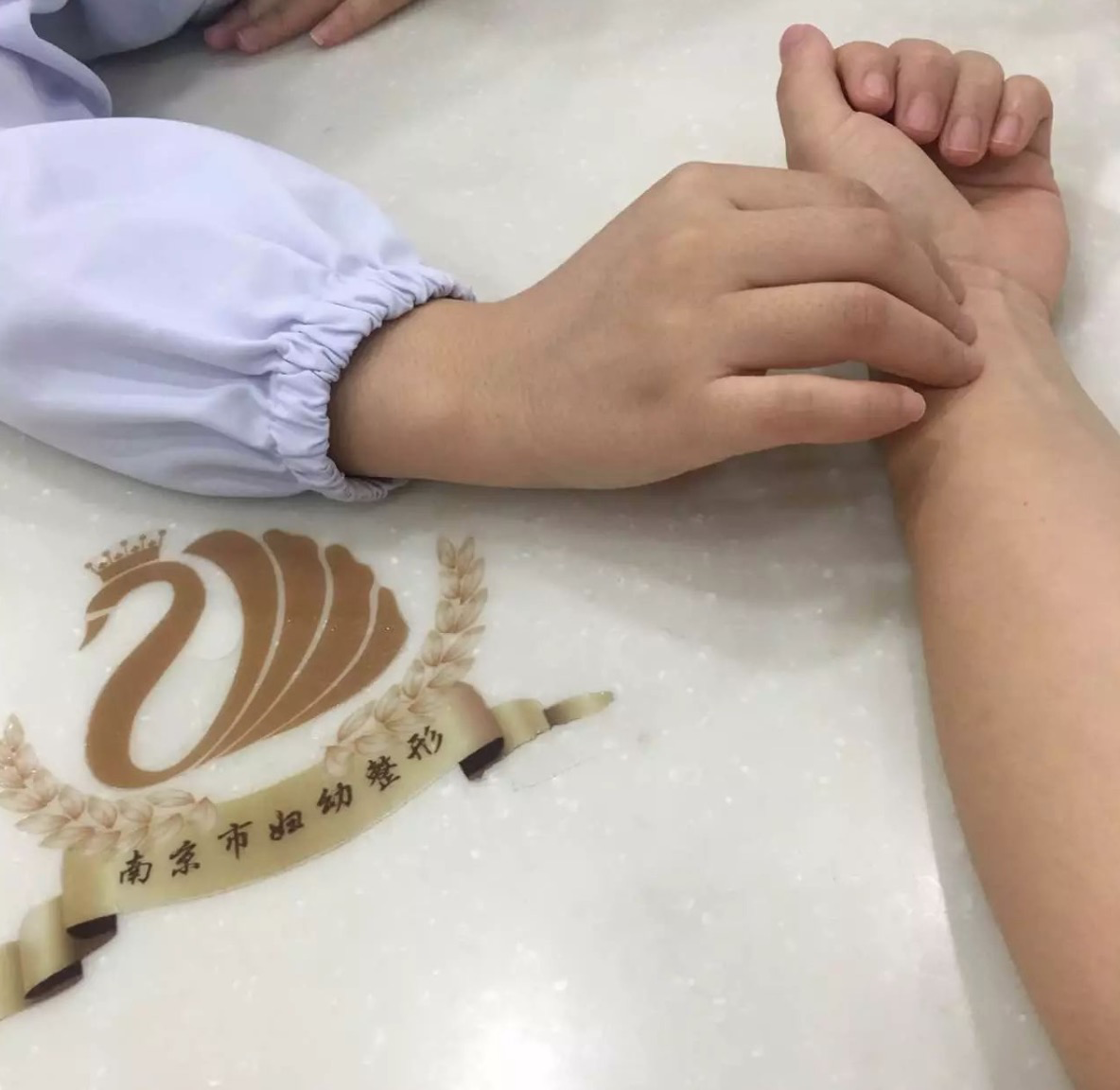 什么是埋線減肥呢 埋線減肥好不好呢