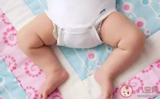 青蛙腿是什么意思  孩子青蛙腿怎么辦