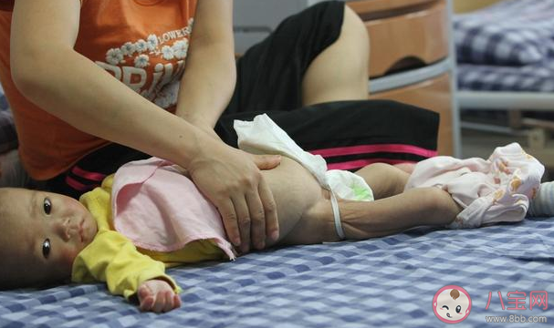 寶寶拉稀需不需要吃藥 寶寶拉稀什么情況下要吃藥