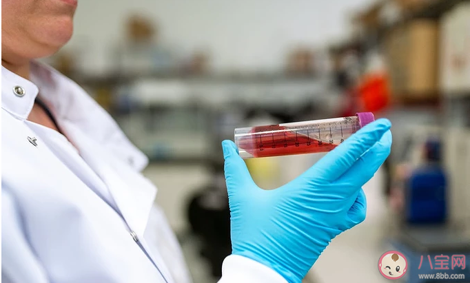 驗孕棒測出兩條還需要去醫(yī)院做早孕檢查嗎 早孕檢查方法有哪些 驗孕棒測出兩條還需要去醫(yī)院做早孕檢查嗎 早孕檢查方法有哪些