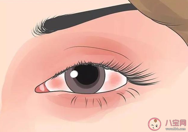 眼皮一直跳怎么辦 怎么減少眼皮跳動的情況出現