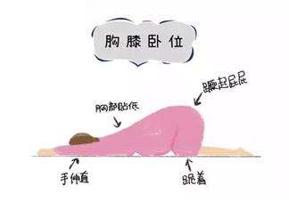 胎位不正臀位怎么辦 胎位不正臀位怎么調整過來