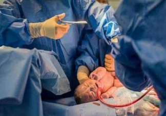 剖腹產后傷口疼痛可以用止痛藥嗎 剖腹產后用止痛藥對身體有影響嗎