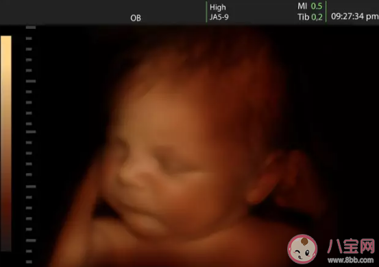 四維怎么讓寶寶動的歡  查四維孩子趴著的有什么辦法