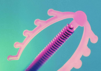 節育環能不能不取  節育環超期使用會怎樣