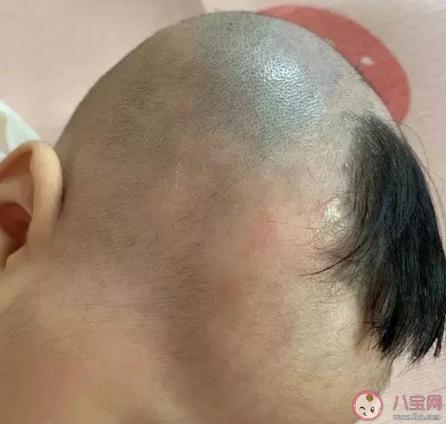 夏天給寶寶剃光頭有什么危害 如何給孩子剪一個既涼快又安全的發型
