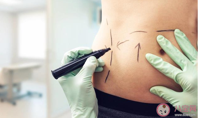 吸脂手術是減肥手術嗎 吸脂手術有什么危害