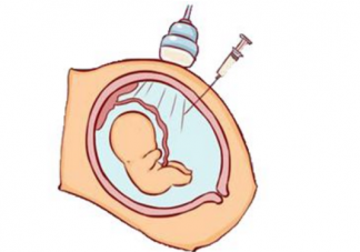 高齡孕婦不想做羊穿怎么辦  哪些人不適合羊水穿刺