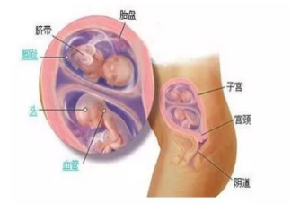自然懷孕會分裂成雙胞胎嗎  生雙胞胎可以遺傳嗎
