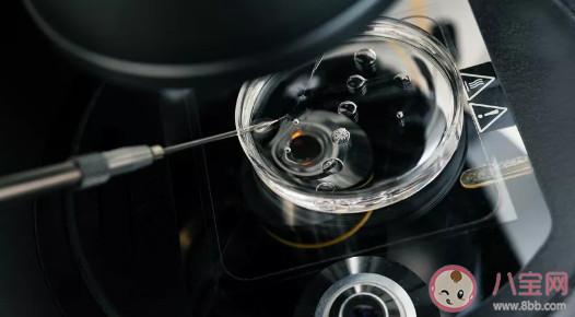 你能接受單身女性冷凍卵子嗎  冷凍卵子可以保持多久