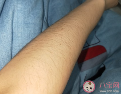 女生汗毛太多的煩惱 女生汗毛太多怎么辦 女生汗毛太多的煩惱 女生汗毛太多怎么辦