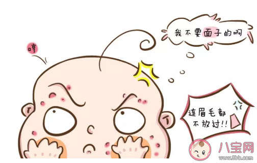 夏季預防寶寶長痱子的小妙招 預防痱子吃什么好