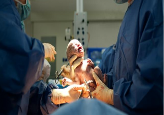 剖腹產前必須禁食嗎 剖腹產前需要禁食多久