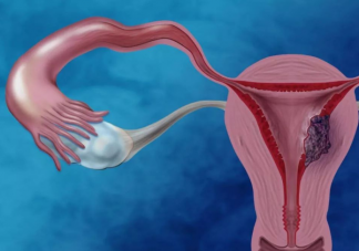 子宮衰老有什么癥狀 如何減緩子宮衰老的速度