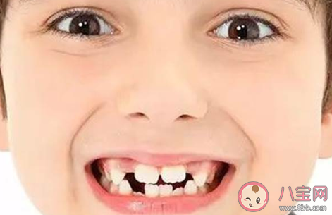 孩子換牙期間不愛吃飯?jiān)趺崔k 孩子換牙期間要注意些什么