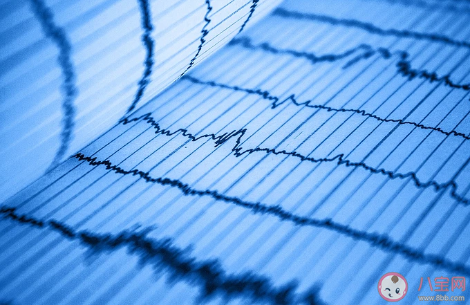 做心電圖心律不齊嚴(yán)重嗎 出現(xiàn)心律不齊要注意什么