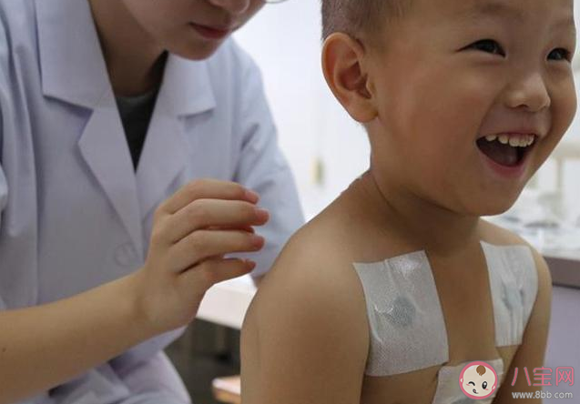 2020三伏貼幾月份開始貼 孩子貼三伏天皮膚過敏灼傷是怎么回事