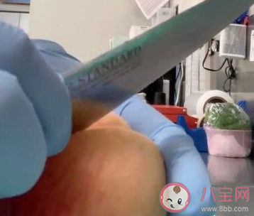 水蜜桃完美去皮方法 水蜜桃要去皮吃嗎