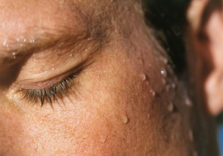 愛出汗的人是屬于什么體質 經常出虛汗怎么辦