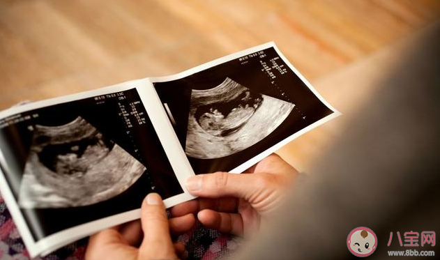 懷孕早期應該做陰超還是腹超 孕早期做陰道B超會不會影響胎兒