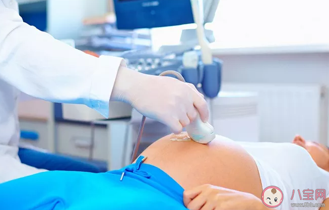 懷孕早期應該做陰超還是腹超 孕早期做陰道B超會不會影響胎兒