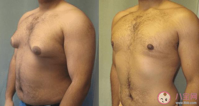 男人的胸有什么作用 為什么有些男人的胸很大