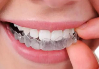 牙洞補牙要戴牙套嗎 什么樣的補牙情況要戴牙套