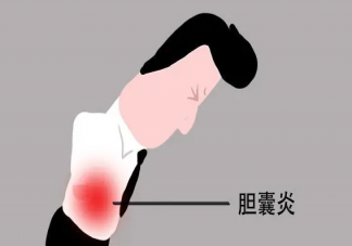 膽囊炎是怎么引起的 吃檳榔會膽囊炎發作嗎