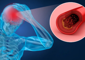 高血壓吃葉酸片什么時(shí)候吃最好 高血壓人吃葉酸片管用嗎