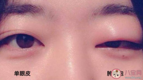 哪些人不能做去腫眼泡手術呢 去腫眼泡手術有副作用嗎。