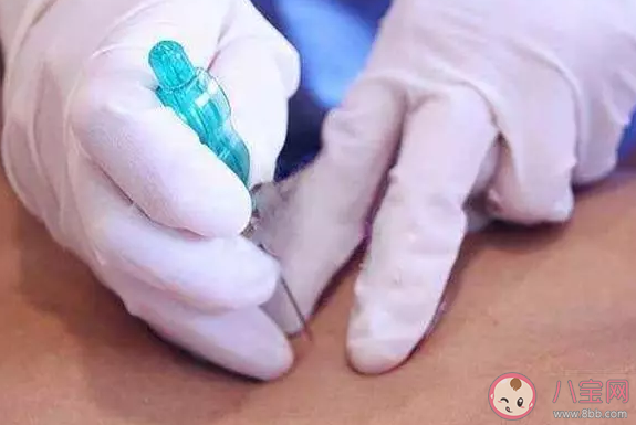 埋線減肥過程中有副作用嗎 埋線減肥后有哪些注意事項(xiàng)