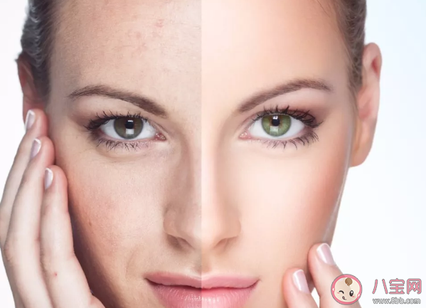 熱瑪吉做一次可以保持多久 熱瑪吉能維持多長(zhǎng)時(shí)間