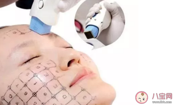 熱瑪吉做一次可以保持多久 熱瑪吉能維持多長(zhǎng)時(shí)間