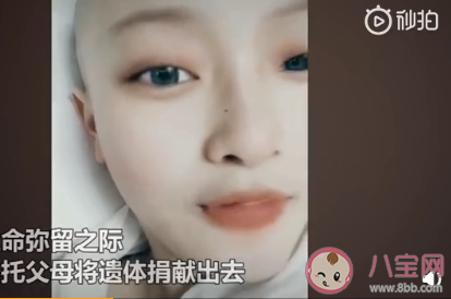 淋巴瘤是怎么產生的病因有哪些 淋巴瘤該如何防治