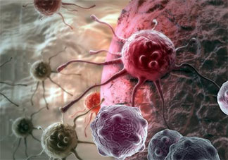 青少年為什么會(huì)得淋巴瘤 淋巴瘤的早期癥狀是什么