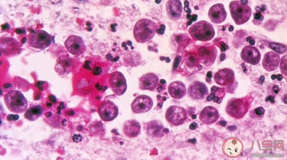 食腦蟲有多可怕 食腦蟲致死率有多高 食腦蟲有多可怕 食腦蟲致死率有多高