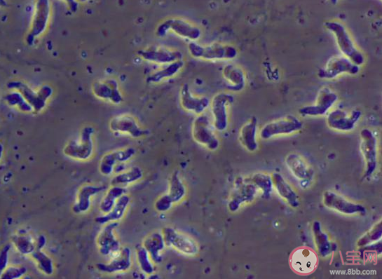 食腦蟲有多可怕 食腦蟲致死率有多高 食腦蟲有多可怕 食腦蟲致死率有多高
