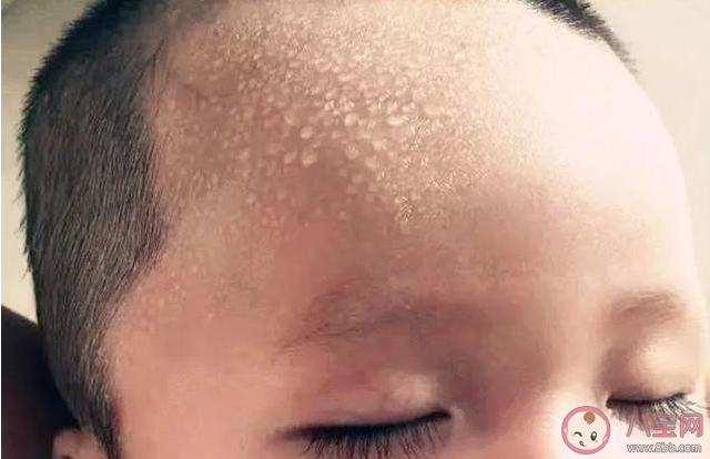孩子什么情況下出汗不正常 孩子夜間愛出汗正常嗎