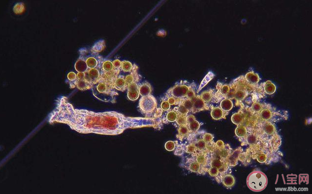 食腦蟲是什么 食腦蟲生長在什么地方 食腦蟲是什么 食腦蟲生長在什么地方