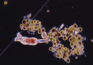 食腦蟲是什么 食腦蟲生長(zhǎng)在什么地方