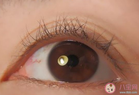 種睫毛會不會影響自己的睫毛生長 種植眼睫毛好不好