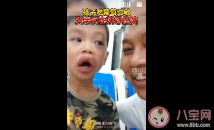 男孩吃葡萄過敏怎么回事 孩子過敏了怎么處理