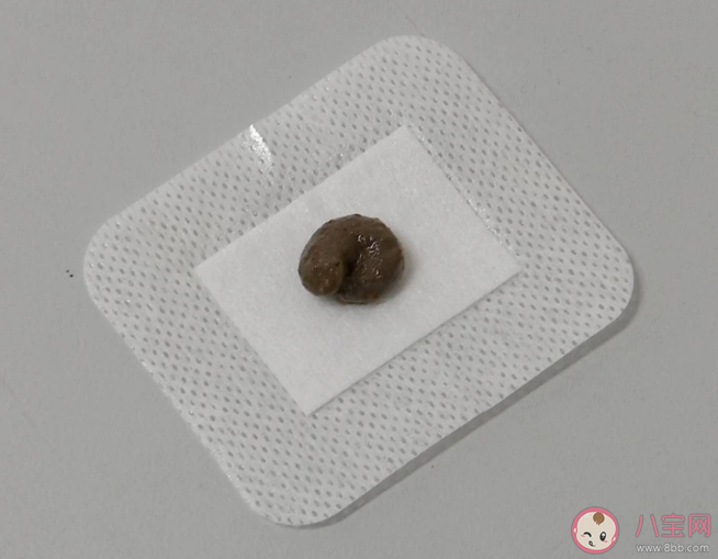 可以網購三伏貼自己貼嗎 網購三伏貼靠譜嗎